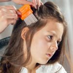 Discover 10 Natural Ways to Fight Lice at Home