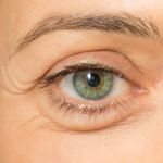 Natural Remedies for Reducing Eye Swelling