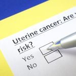10 Symptoms of Uterine Cancer