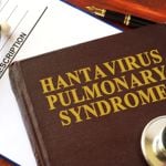 10 Symptoms Indicative of Hantavirus