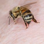 10 Home Remedies for Bee Stings