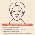 10 Symptoms of Bell's palsy
