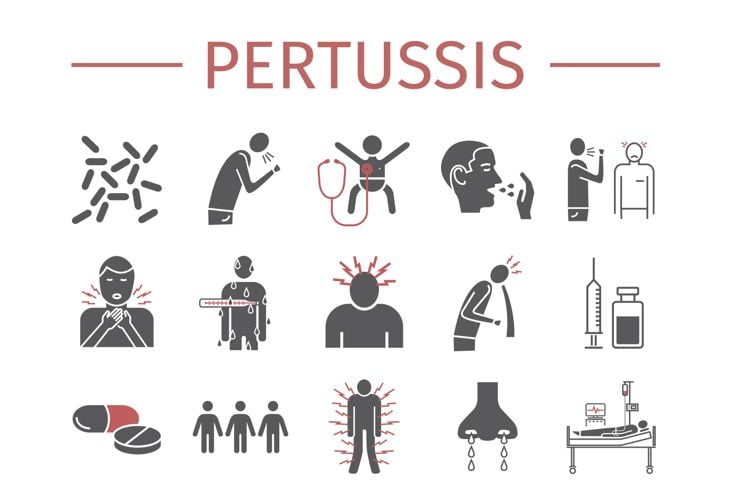 Pertussis signs. Whooping cough