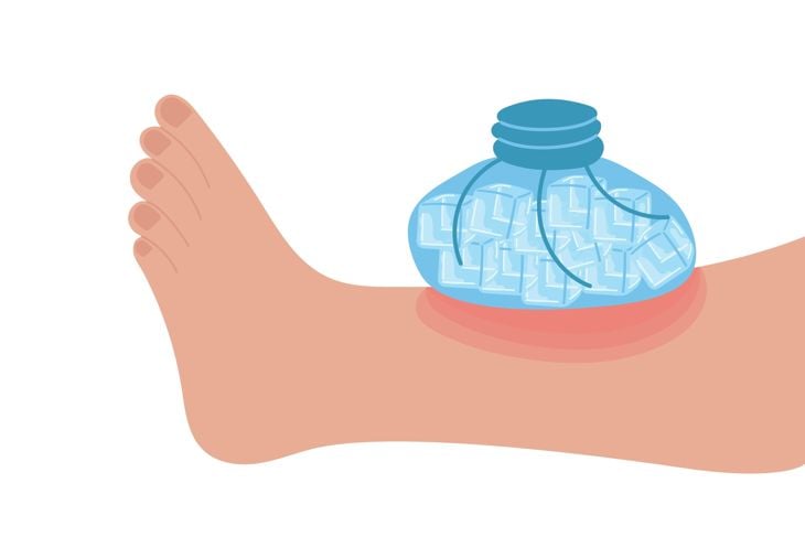 Ice pack applied to leg with bruise