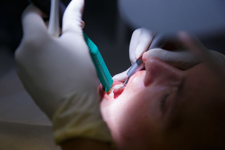 15 Simple Remedies to Alleviate Gum Disease Symptoms