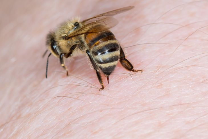 10 Home Remedies for Bee Stings