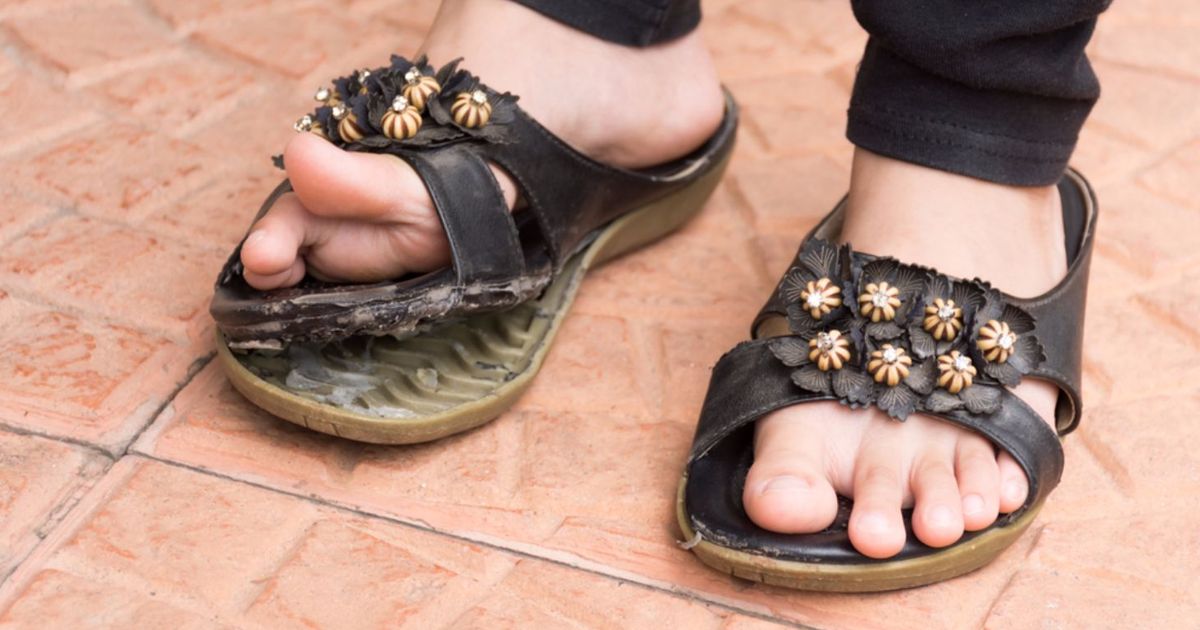 10 Common Foot Problems Facty Health