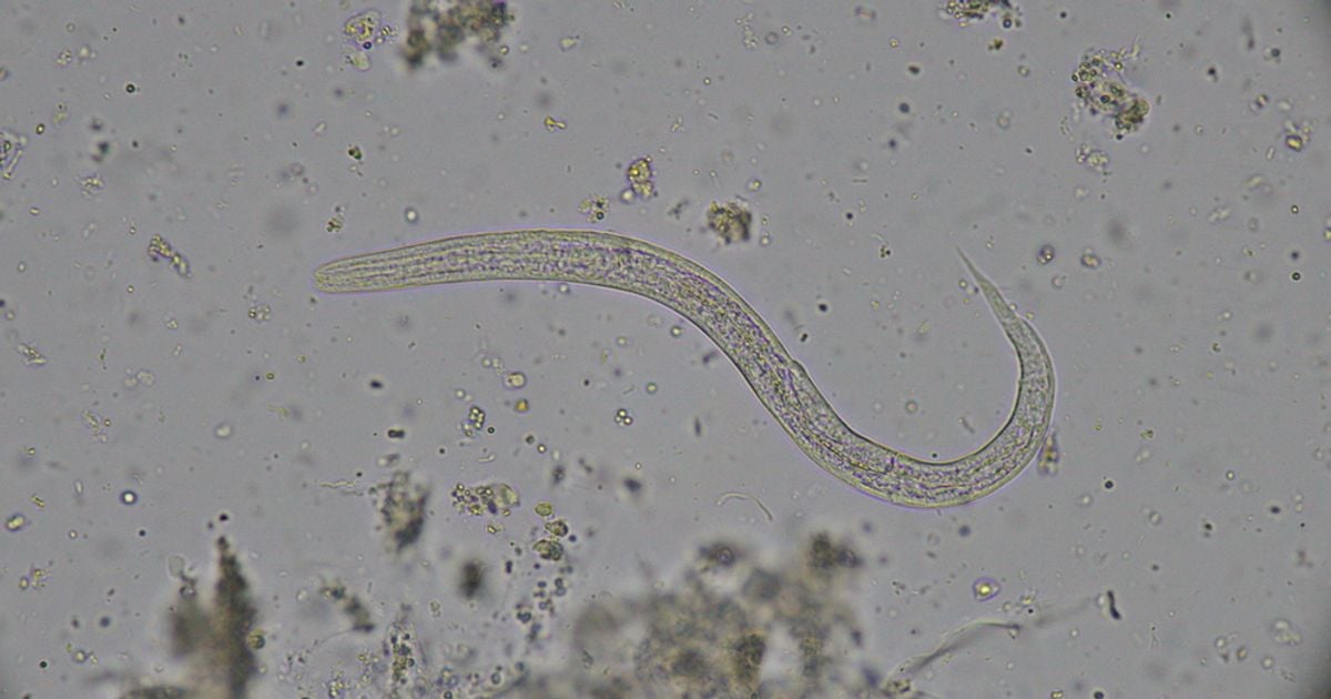 10 Symptoms of Hookworm Facty Health