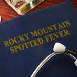 10 Symptoms of Rocky Mountain Spotted Fever
