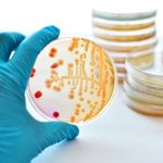 10 Symptoms of Diphtheria