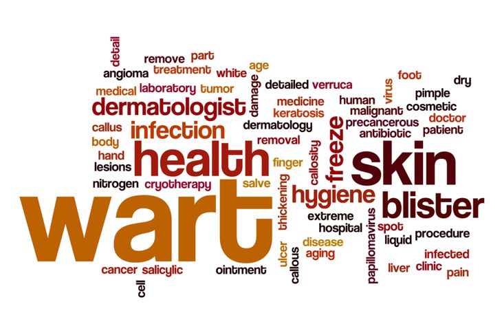 Effective Wart Removal: 10 Home Remedies You Should Try