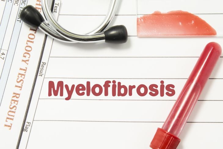 10 Myelofibrosis Symptoms That Are Easy to Overlook