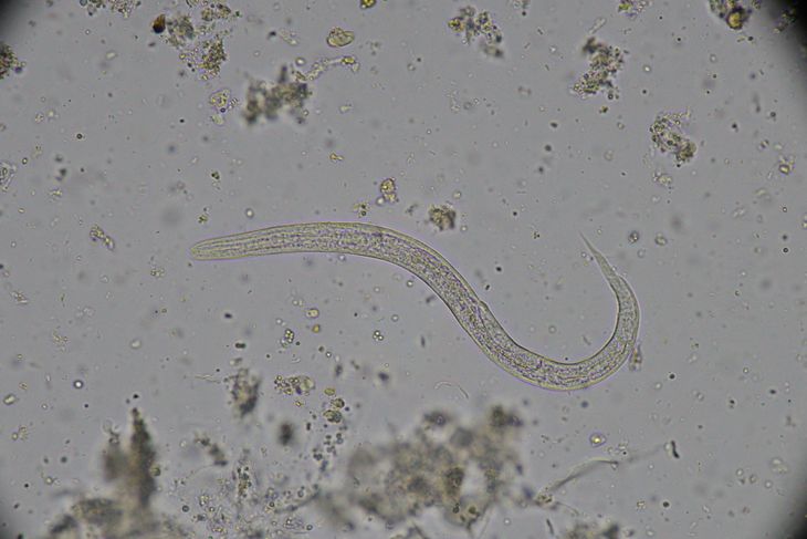 10 Symptoms of Hookworm