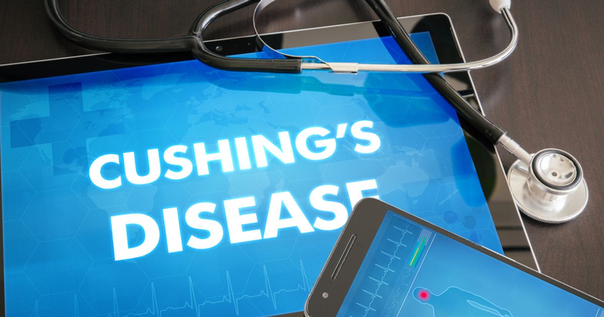 10 Signs of Cushing's disease Facty Health