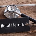 The Urgency of Treating Hiatal Hernia: 10 Effective Methods