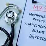 12 Effective Natural Remedies for MRSA