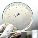 A Closer Look: 10 Symptoms Indicating E. coli Presence