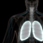10 Symptoms of Legionnaire's Disease