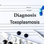 Exploring the Causes of Toxoplasmosis