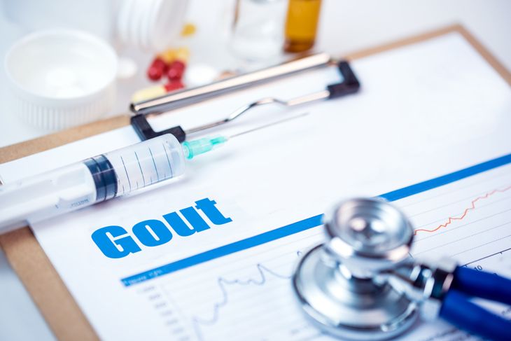 Understanding Gout: A Guide to its 12 Symptoms