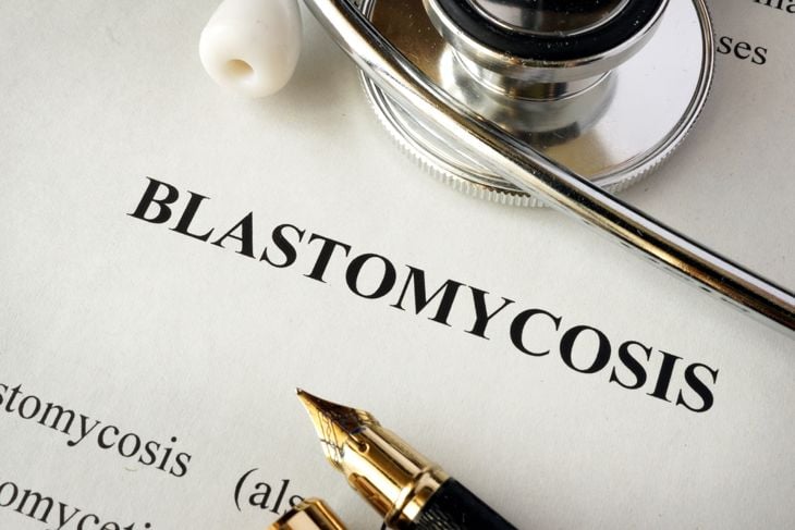10 Signs and Treatments for Blastomycosis