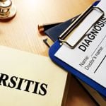 Can Changing Your Sleeping Habits Help Bursitis?