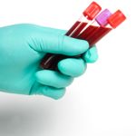Facts You Should Know About White Blood Cell Count