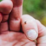Recognizing and Treating Tick Bite Symptoms