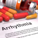 Understanding Arrhythmia: 10 Symptoms You Shouldn't Ignore