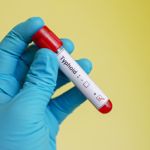 10 Symptoms of Typhoid Fever