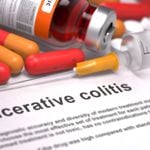 10 Treatments of Ulcerative Colitis