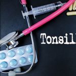 10 Symptoms and Causes of Tonsillitis