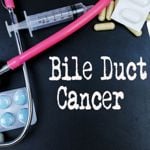10 Symptoms of Bile Duct Cancer