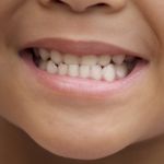 10 Treatments for Tooth Decay