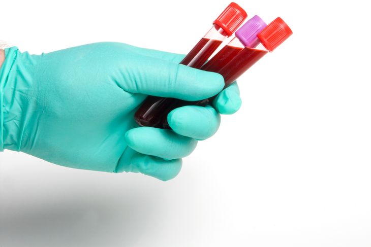 Facts You Should Know About White Blood Cell Count