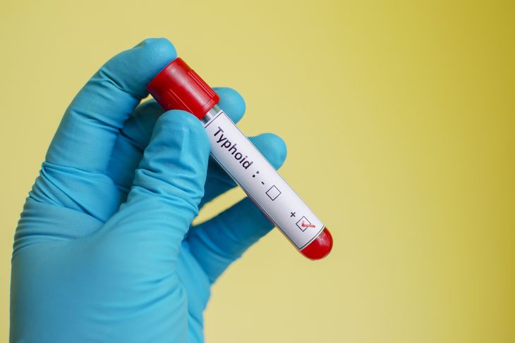 10 Symptoms of Typhoid Fever