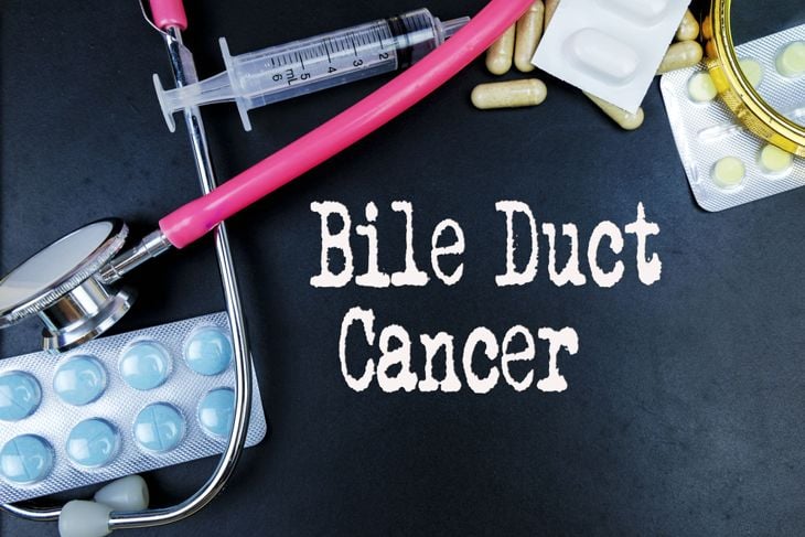 10 Symptoms of Bile Duct Cancer