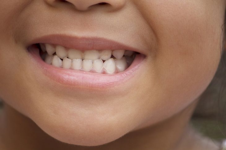 10 Treatments for Tooth Decay