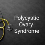 Polycystic Ovary Syndrome: 10 Symptoms That Demand Your Attention