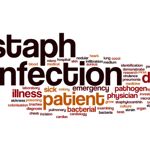 The Ten Reasons Why Staph Infections Occur