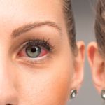 What Causes Red Eyes?