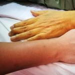The 10 Health Conditions That Can Trigger Jaundice