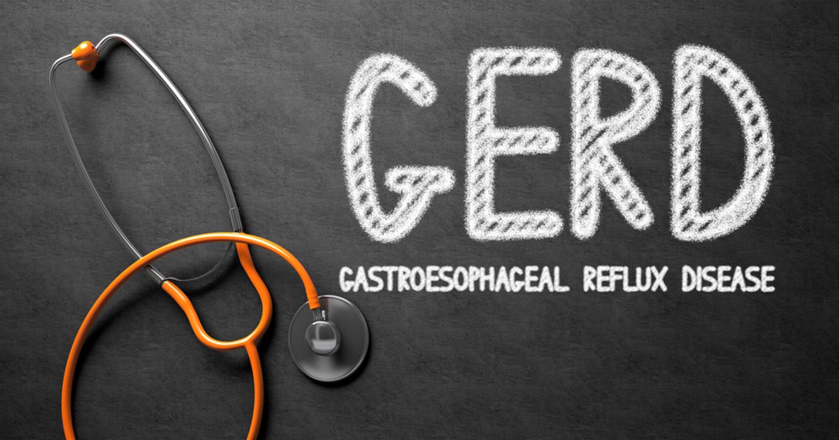 10 Treatments for GERD Facty Health