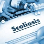 13 Warning Signs of Scoliosis You Shouldn't Ignore