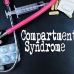 Treatments for Compartment Syndrome