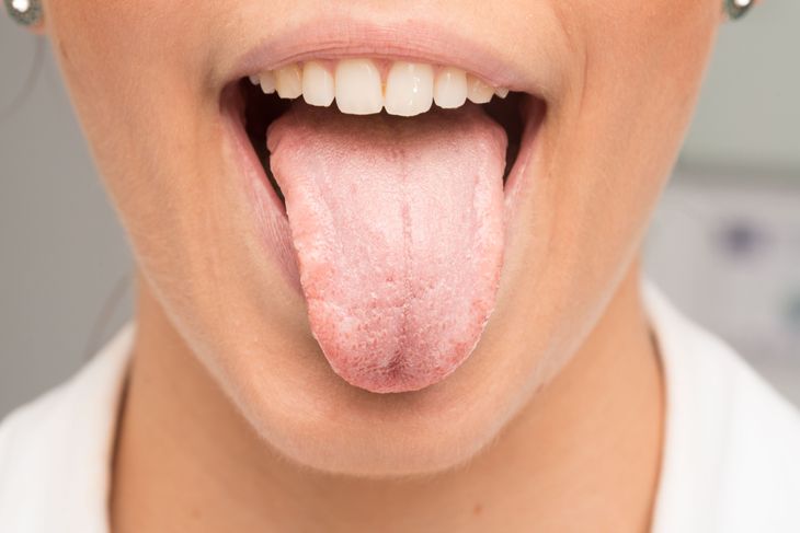Decoding Candida Overgrowth: 10 Symptoms You Shouldn't Ignore