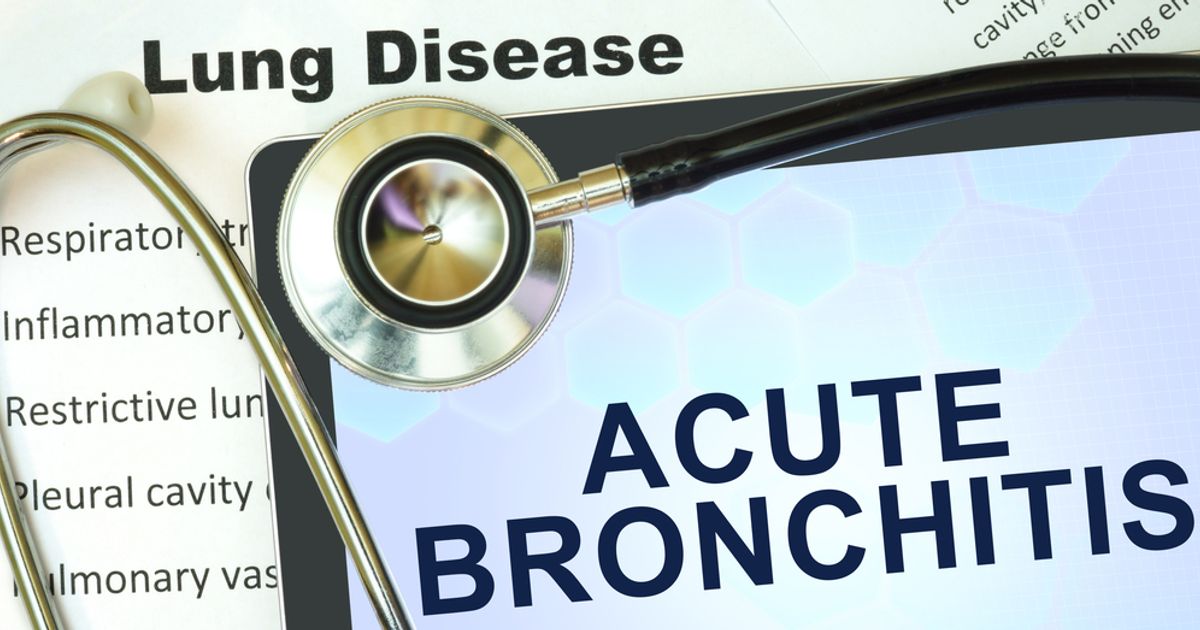 10 common signs and treatments of acute bronchitis Facty Health