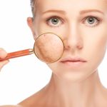Is Lichen Sclerosus Causing Your Skin Discomfort? Find Out Here
