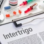 10 Treatments for Intertrigo