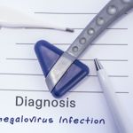 10 Symptoms of Cytomegalovirus (CMV)